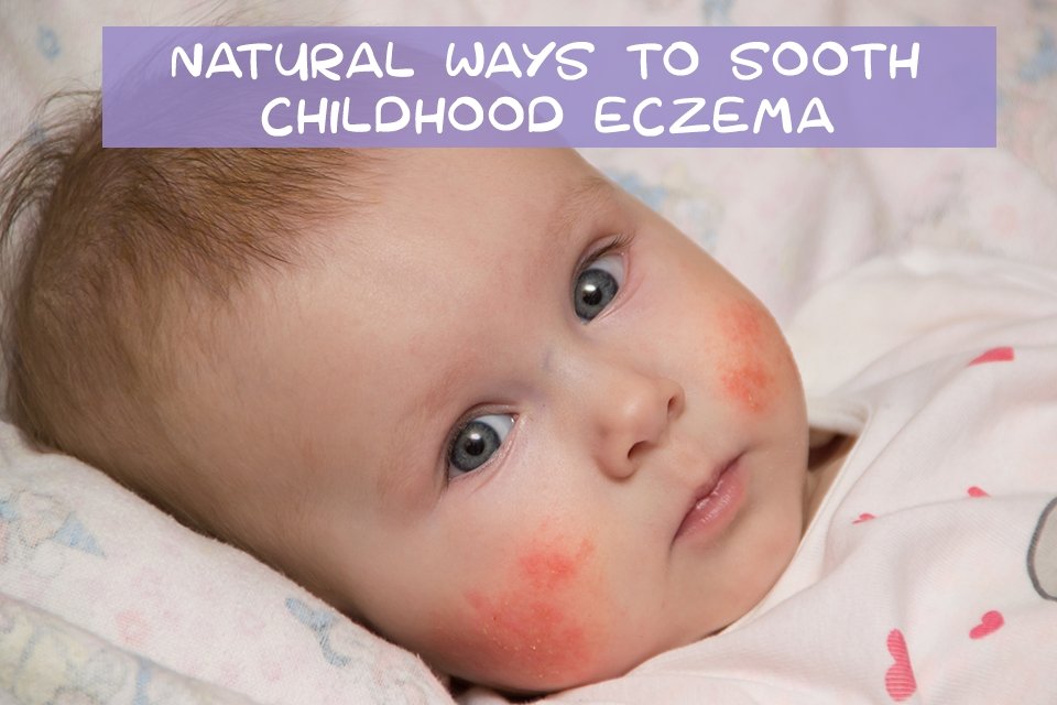 Natural Ways to Sooth Childhood Eczema